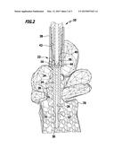 MEDICAL INSTRUMENT diagram and image