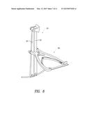 PERCUTANEOUS COMPRESSION AND DISTRACTION SYSTEM diagram and image