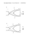 PERCUTANEOUS COMPRESSION AND DISTRACTION SYSTEM diagram and image