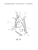 PERCUTANEOUS COMPRESSION AND DISTRACTION SYSTEM diagram and image