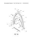 PERCUTANEOUS COMPRESSION AND DISTRACTION SYSTEM diagram and image