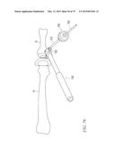 SOFT TISSUE REPAIR diagram and image