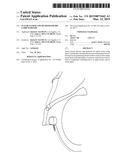 SUTURE PASSER AND METHOD FOR HIP LABRUM REPAIR diagram and image