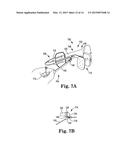 ROTATIONAL ATHERECTOMY DEVICE WITH EXCHANGEABLE DRIVE SHAFT AND MESHING     GEARS diagram and image