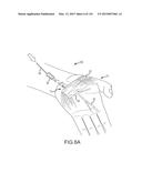 SYSTEMS AND METHODS FOR TREATMENT OF COMPRESSED NERVES diagram and image