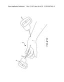 SYSTEMS AND METHODS FOR TREATMENT OF COMPRESSED NERVES diagram and image