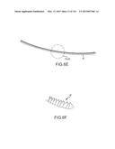 SYSTEMS AND METHODS FOR TREATMENT OF COMPRESSED NERVES diagram and image