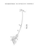 SYSTEMS AND METHODS FOR TREATMENT OF COMPRESSED NERVES diagram and image