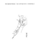 SYSTEMS AND METHODS FOR TREATMENT OF COMPRESSED NERVES diagram and image