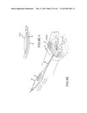 SYSTEMS AND METHODS FOR TREATMENT OF COMPRESSED NERVES diagram and image