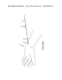 SYSTEMS AND METHODS FOR TREATMENT OF COMPRESSED NERVES diagram and image