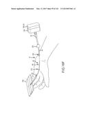 SYSTEMS AND METHODS FOR TREATMENT OF COMPRESSED NERVES diagram and image