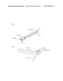 Joint stability device and method diagram and image