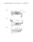 Joint stability device and method diagram and image