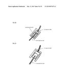 Joint stability device and method diagram and image