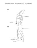 Joint stability device and method diagram and image