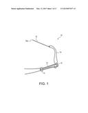 BUNION REPAIR USING SUTURE-BUTTON CONSTRUCT diagram and image