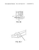 BUNION REPAIR USING SUTURE-BUTTON CONSTRUCT diagram and image