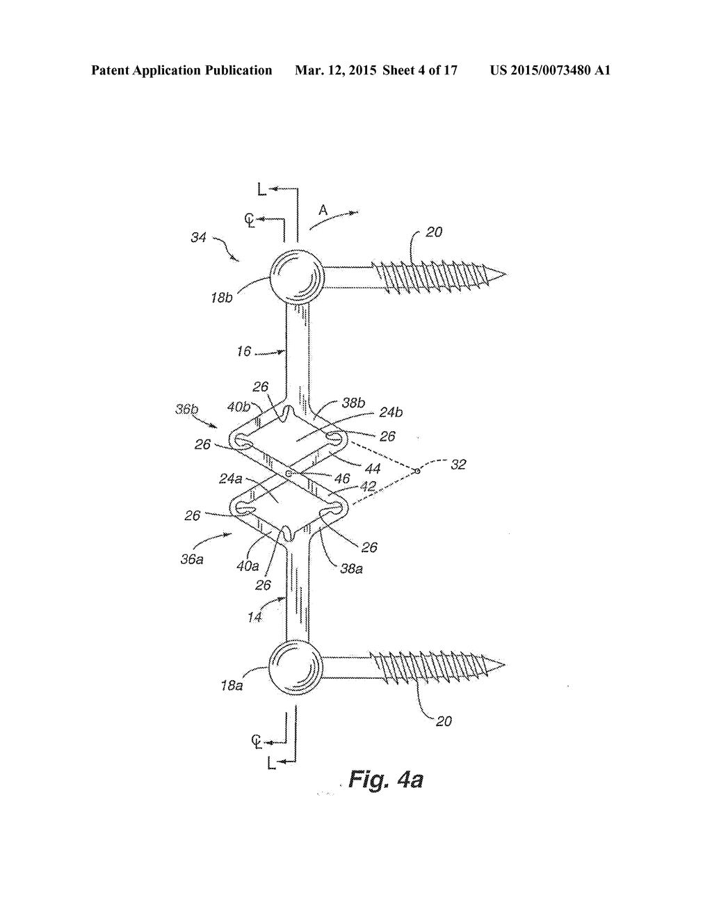 Dynamic Fixation Device and Method of Use - diagram, schematic, and image 05