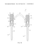 ROD ATTACHMENT FOR HEAD TO HEAD CROSS CONNECTOR diagram and image