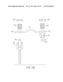 ROD ATTACHMENT FOR HEAD TO HEAD CROSS CONNECTOR diagram and image