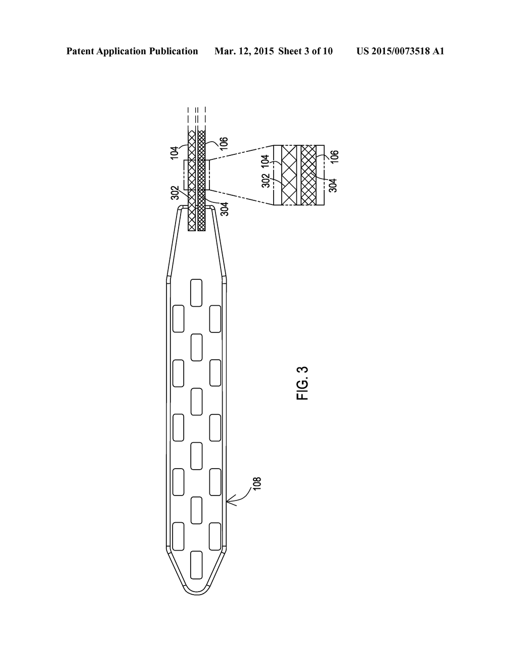 PAIRED MEDICAL LEAD BODIES WITH BRAIDED CONDUCTIVE SHIELDS HAVING     DIFFERENT PHYSICAL PARAMETER VALUES - diagram, schematic, and image 04