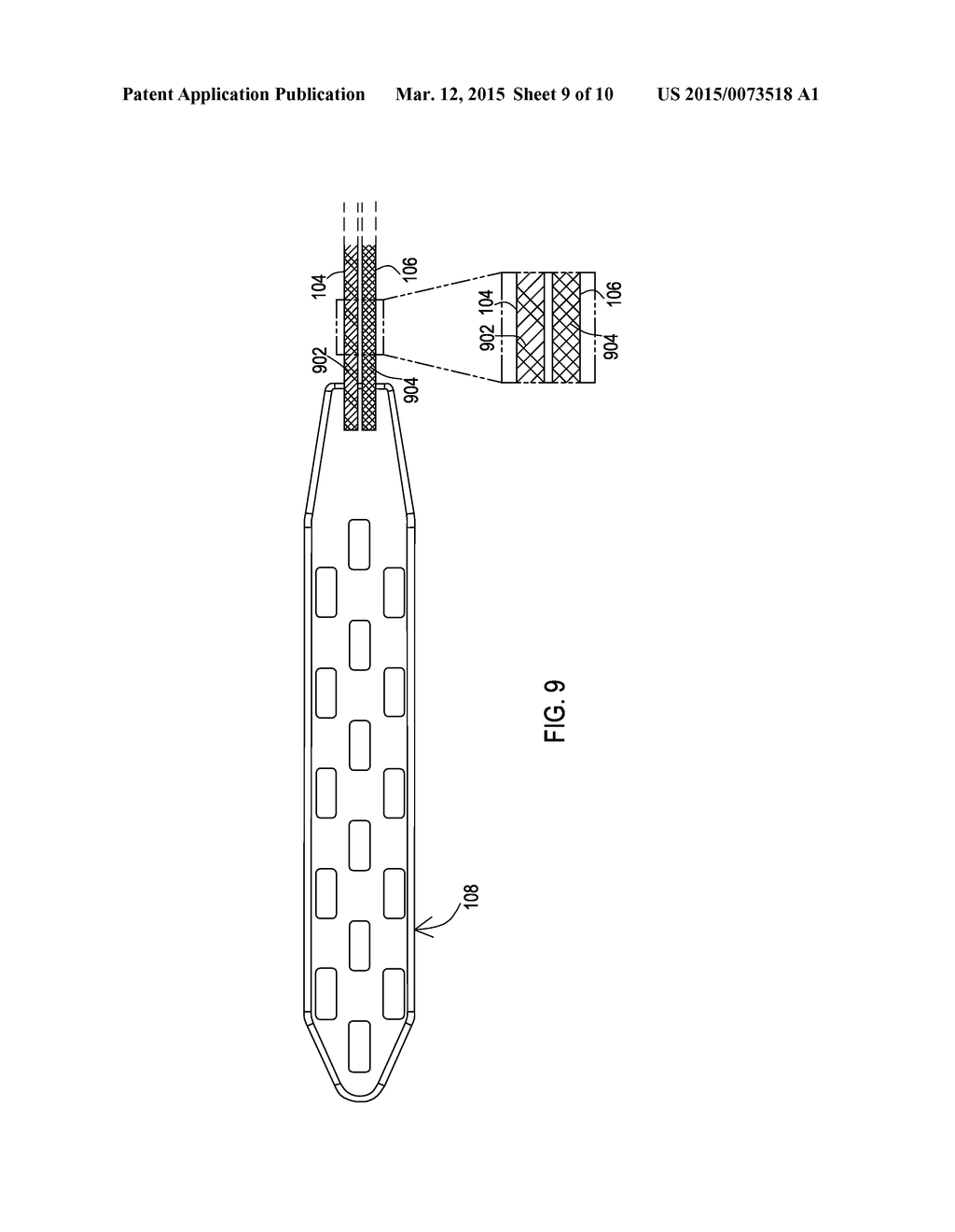 PAIRED MEDICAL LEAD BODIES WITH BRAIDED CONDUCTIVE SHIELDS HAVING     DIFFERENT PHYSICAL PARAMETER VALUES - diagram, schematic, and image 10