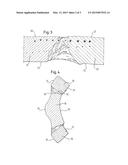 Implant with Attached Element and Method of Making Such an Implant diagram and image