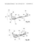 LINKED DEFLECTION DEVICES, SYSTEMS AND METHODS FOR THE PREVENTION OF     STROKE diagram and image