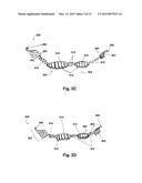 LINKED DEFLECTION DEVICES, SYSTEMS AND METHODS FOR THE PREVENTION OF     STROKE diagram and image