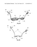 LINKED DEFLECTION DEVICES, SYSTEMS AND METHODS FOR THE PREVENTION OF     STROKE diagram and image