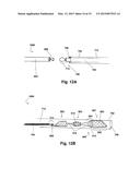 LINKED DEFLECTION DEVICES, SYSTEMS AND METHODS FOR THE PREVENTION OF     STROKE diagram and image