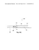 LINKED DEFLECTION DEVICES, SYSTEMS AND METHODS FOR THE PREVENTION OF     STROKE diagram and image