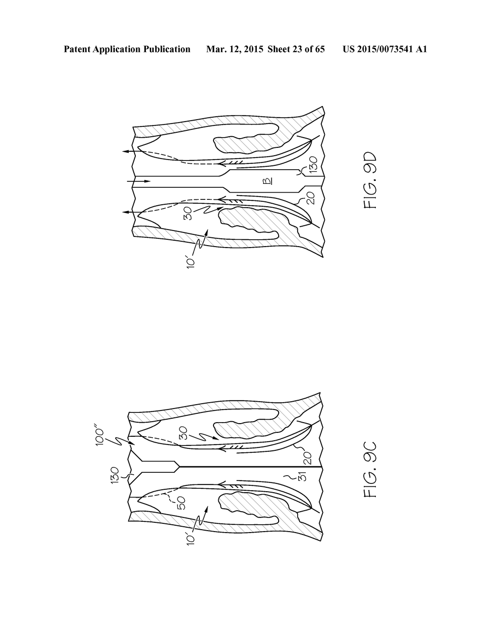 Repositionable Heart Valve and Method - diagram, schematic, and image 24