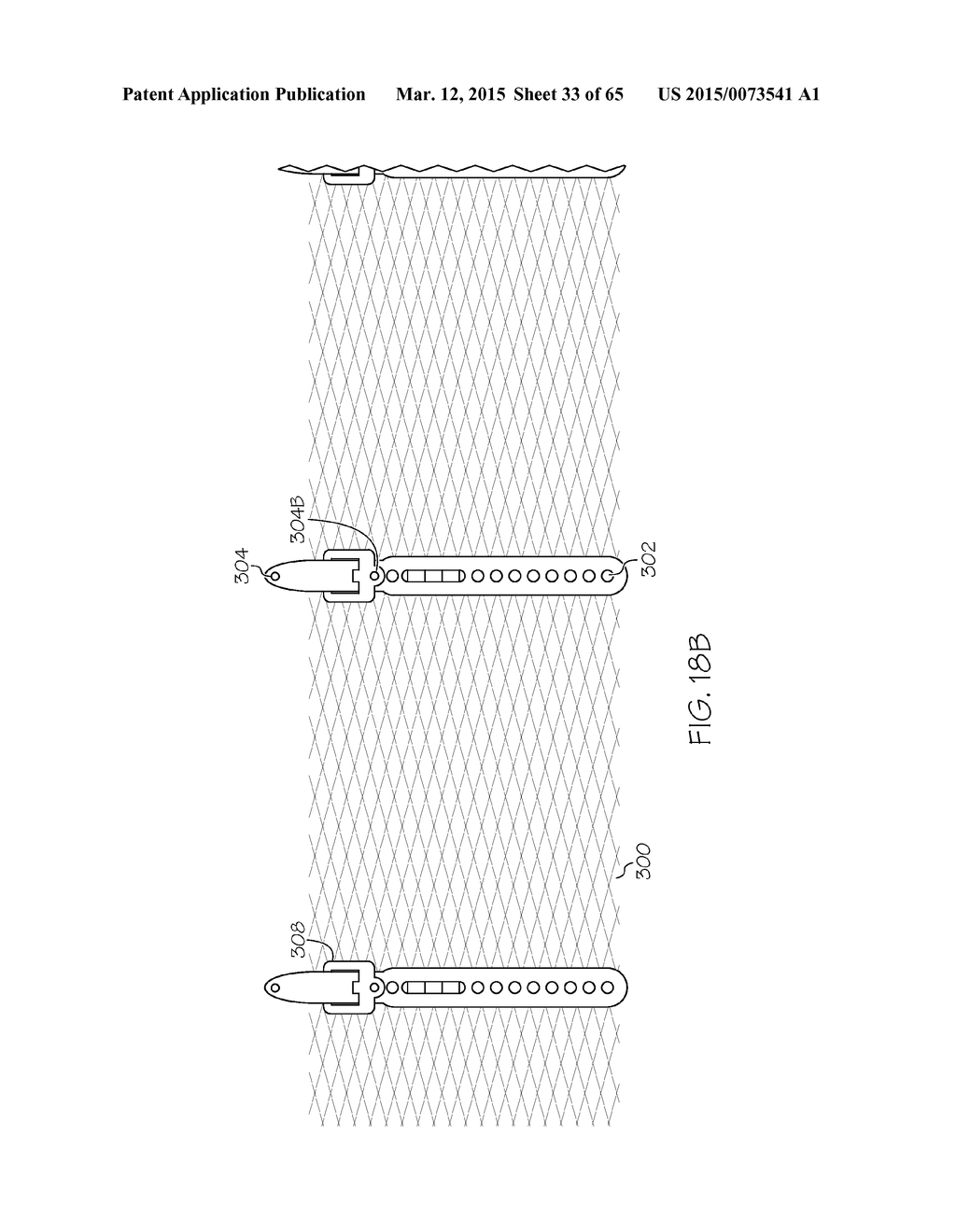 Repositionable Heart Valve and Method - diagram, schematic, and image 34