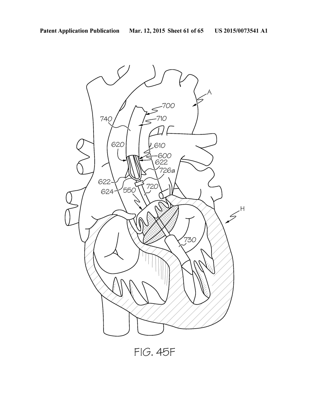 Repositionable Heart Valve and Method - diagram, schematic, and image 62