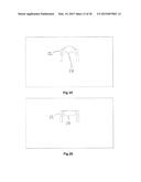 ELASTOMERIC VALVE diagram and image