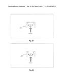 ELASTOMERIC VALVE diagram and image