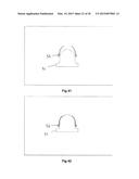 ELASTOMERIC VALVE diagram and image