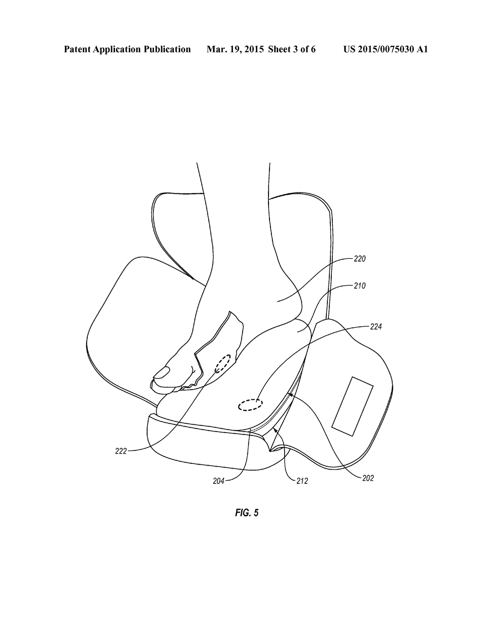 INSOLE FOR AN ORTHOPEDIC DEVICE - diagram, schematic, and image 04