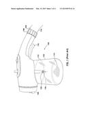 CARTRIDGE FOR A PLANT-TREATMENT PRODUCT SPRAYER, AND RELATED METHODS diagram and image