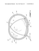 ROTARY INTERNAL COMBUSTION ENGINE WITH EXHAUST PURGE diagram and image