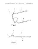 Hair Lifting, Retention, and Styling Device diagram and image