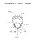 INNER TUBE PROTECTIVE DEVICE diagram and image