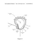 INNER TUBE PROTECTIVE DEVICE diagram and image