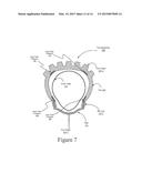 INNER TUBE PROTECTIVE DEVICE diagram and image