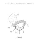 INNER TUBE PROTECTIVE DEVICE diagram and image