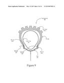 INNER TUBE PROTECTIVE DEVICE diagram and image