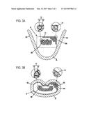 TERMINAL FITTING-EQUIPPED CONDUCTOR diagram and image