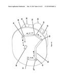 BIOSENSOR DEVICE AND SYSTEM diagram and image